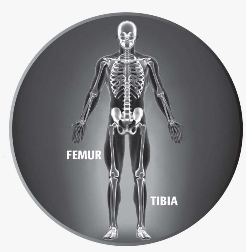 Limb Lengthening Device Options For The Tibia And Femur - Full Body Skeleton X Ray, transparent png download