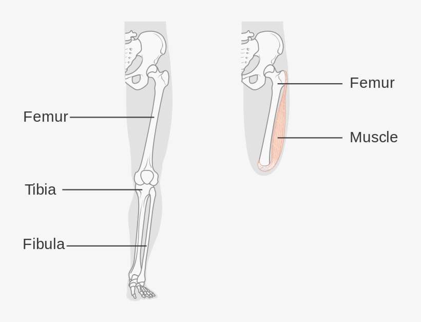 Fig 1 Above Knee Amputation - Above Knee Amputations Diagram, transparent png download