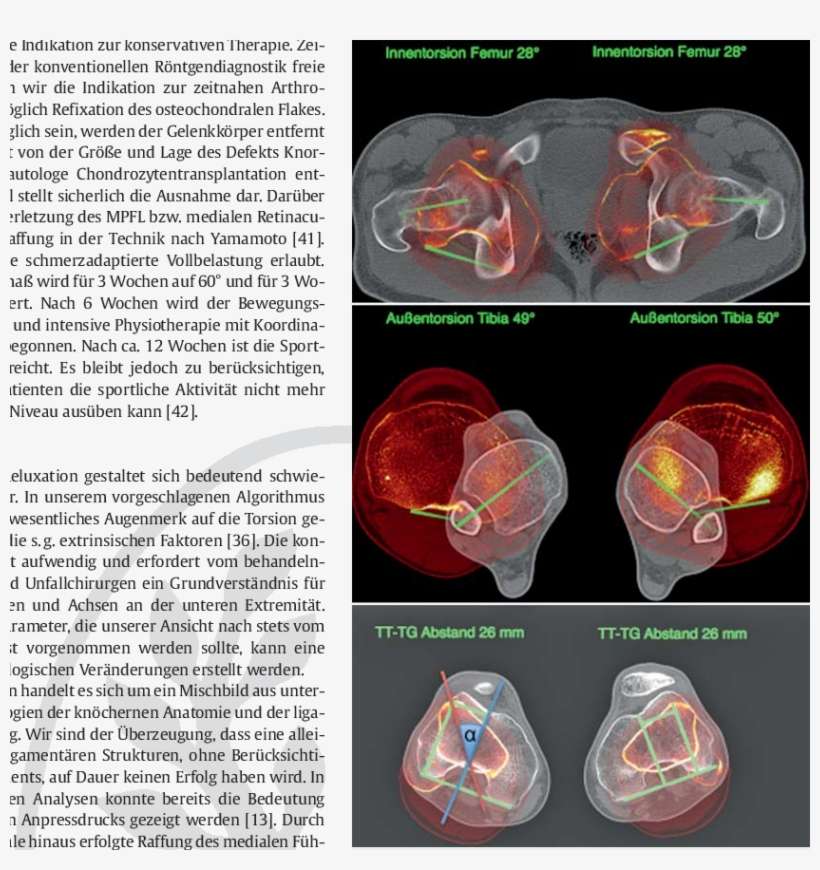 9 Zusammenhang Torsion Und Tt‑tg-abstand - Tt Tg Winkel, transparent png download