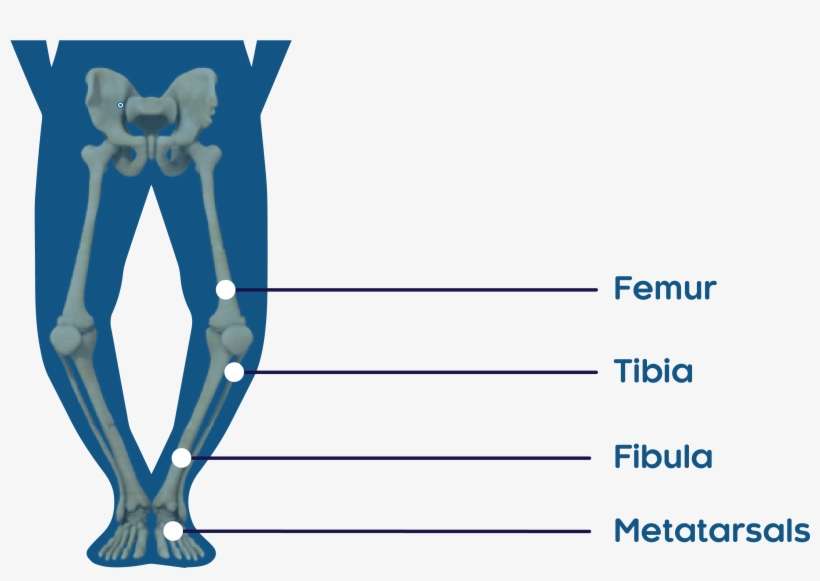 In Study 3, Fractures Were Predominantly Located In - Tibia, transparent png download