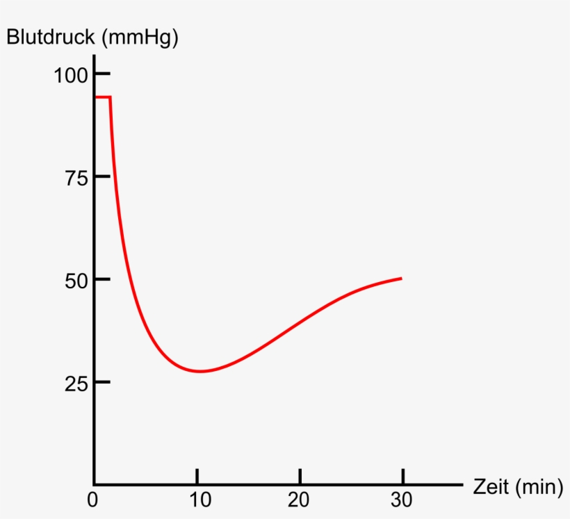 Blood Pressure Of A Anaesthesized Rat Afer Injection - Gdp For Usa, transparent png download
