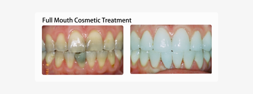 Mouth - Human Mouth, transparent png download