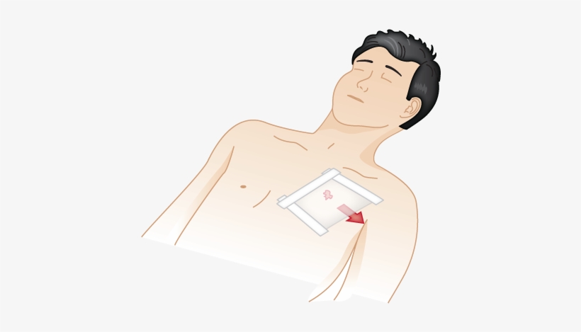 Penetrating Chest Wound - Penetrating Chest Wound First Aid, transparent png download