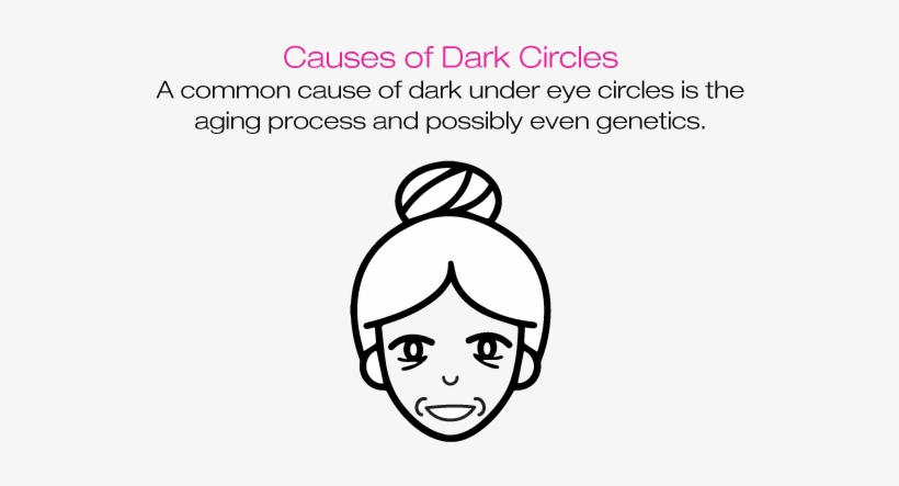 Here Are Some Of The Causes Of Dark Circles, As Well - Botulinum Toxin, transparent png download