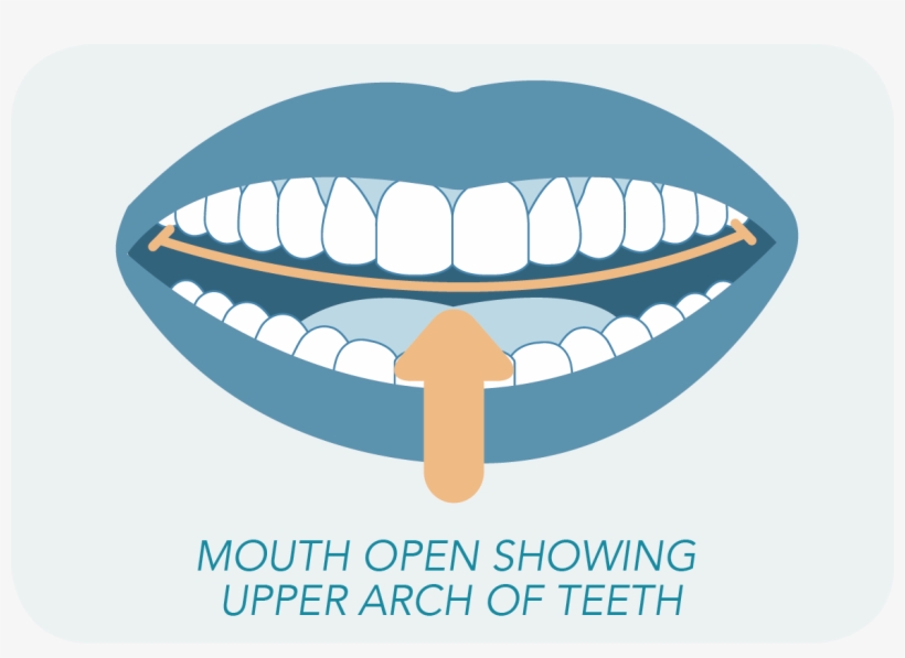 Mouth Open Showing Upper Arch Teeth - Mouth, transparent png download