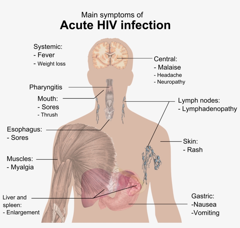 Symptoms Of Acute Hiv Infection - Hiv Symptoms, transparent png download