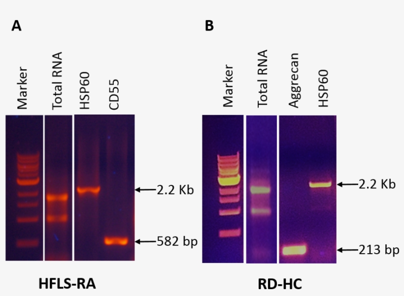 Cell Rna (a) Human Fibroblast Like Synoviocytes, Rheumatoid - Graphic Design, transparent png download