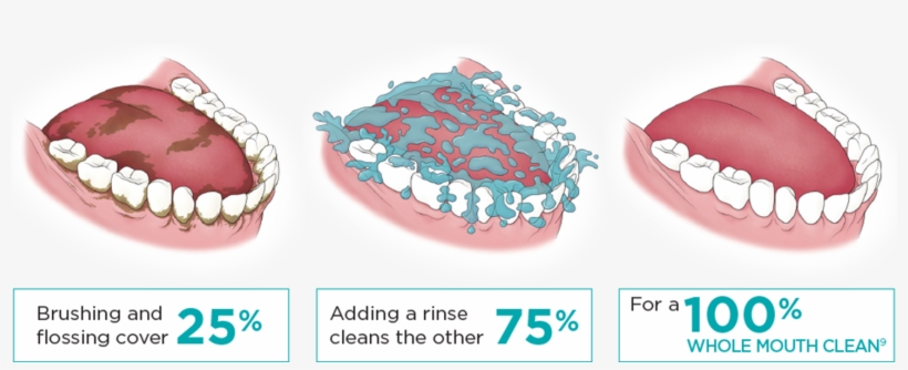 100% Whole Mouth Clean9 - Biofilm Mouth, transparent png download