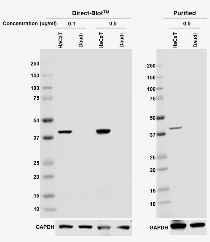 Direct Blot Hrp Anti Cytokeratin 19 Antibody Anti Cytokeratin - Antibody, transparent png download
