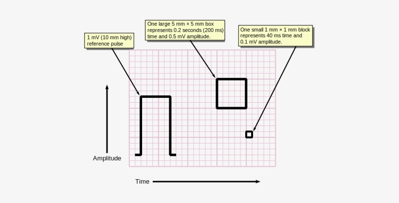 Ecg Paper V2 - Ecg Graph Paper, transparent png download