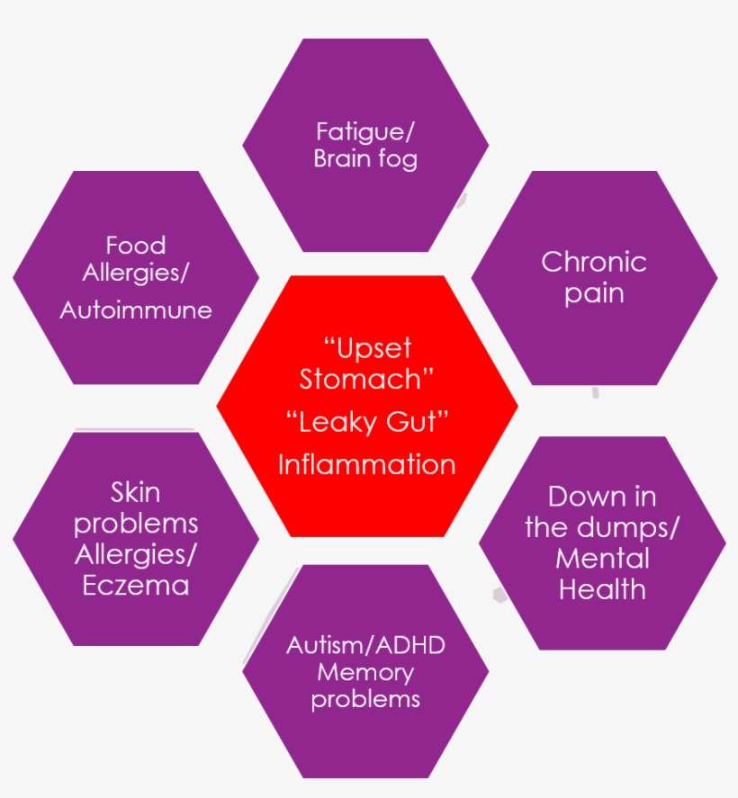 Free Download Strategic Planning Lifecycle Clipart - Software Defined Storage, transparent png download
