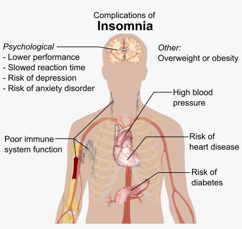 Complications Of Insomnia - Tell If You Have Insomnia, transparent png download