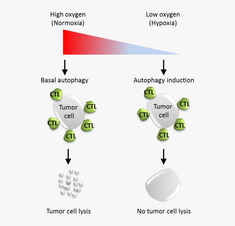 Figure 1 - - Autophagy Tumor, transparent png download