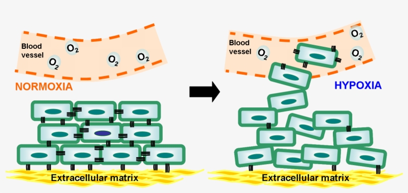 These May Prevent The Detachment Of Cancer Cells From - Hypoxic Cells In Cancer, transparent png download