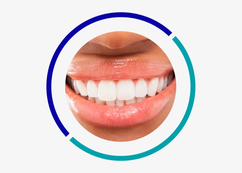 Cosmetic Dentistry - Black Woman White Teeth, transparent png download