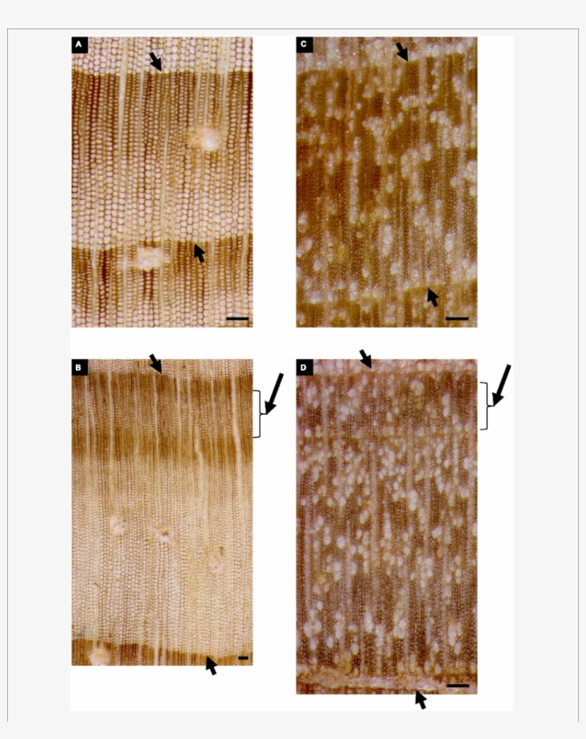 Reflected Light Microscopy View Of The Tree Ring Corresponding - Tree, transparent png download