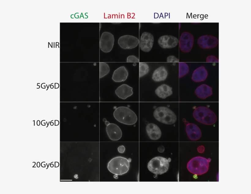 Immunofluorescent Staining Shows Co-staining Of Lamin - Micronuclei Cgas, transparent png download