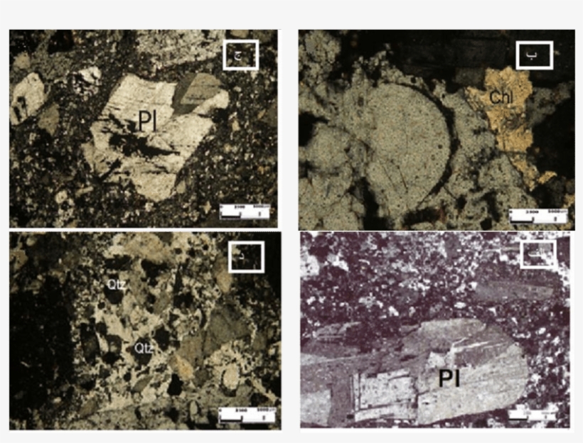 Microscopic Images Of The Textures Of Zone: A) Microcytic - Visual Arts, transparent png download