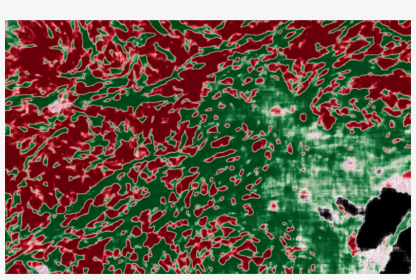 Ai Image Overlay Of Pathology Image - Artificial Intelligence, transparent png download
