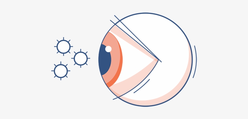 Eye Allergy Symptoms - Allergy, transparent png download