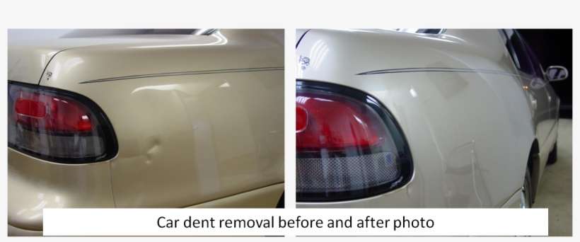 Paintless Dent Repair Boynton Beach, Fl - Dents Are Removed From Cars, transparent png download