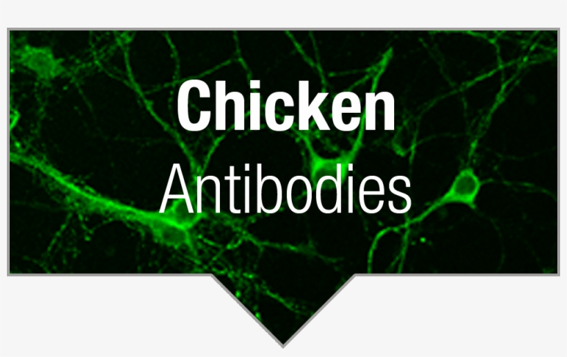 1001 Deadly Checkmates, transparent png download