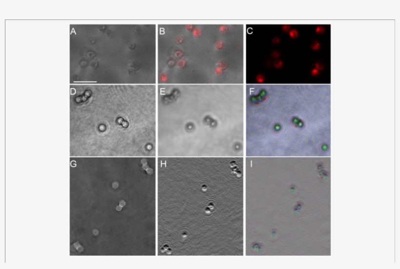 Picocystis Salinarum Under Light Microscopy And Dhm - Lensless Imaging Of E Coli, transparent png download
