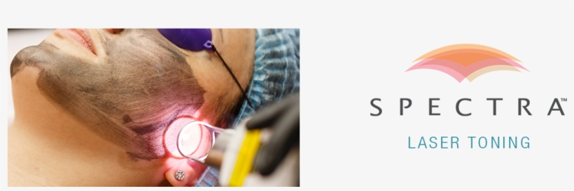 Spectra Laser Toning - Laser, transparent png download