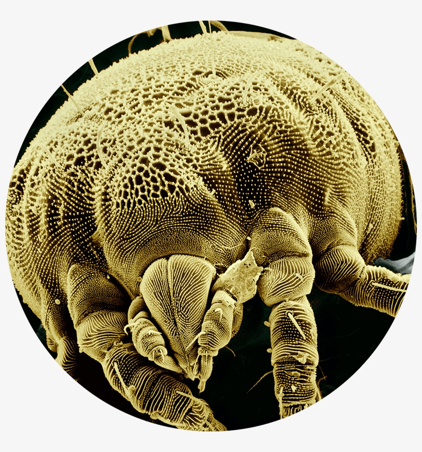 Ácaros En El Colchón - Does A Tummy Bug Look Like, transparent png download