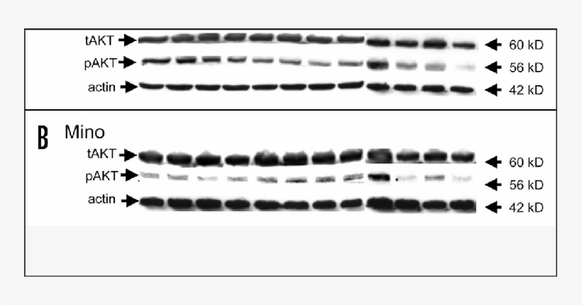 Jeko And Mino (b) Cell Lines Were Cultured In The Presence - Cruise Ship, transparent png download
