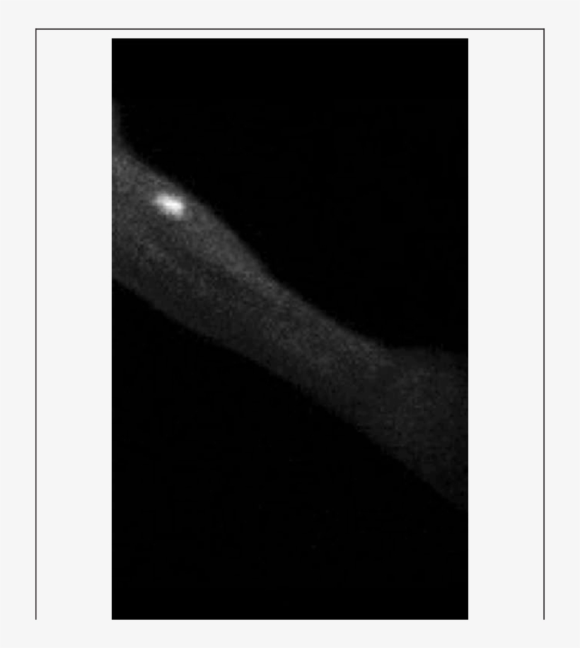 Tc Uptake At The Transplanted Forearm Site - Forearm, transparent png download