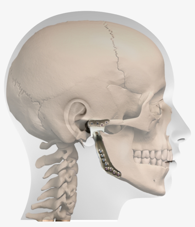 Profile Prosthesis - Frankfort Horizontal Plane Dental, transparent png download