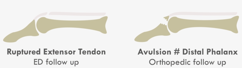 Tendon Injuries Tend To Show Less Swelling/tenderness, transparent png download