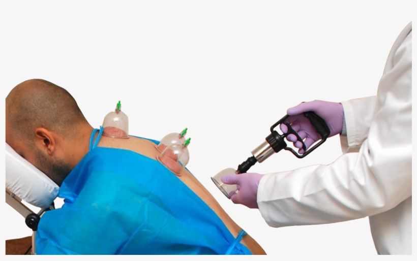 Mobile Main Menu - Hijama Cupping Hd Image Png, transparent png download