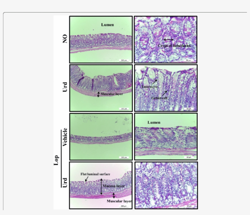 Alteration Of Histological Structures In Lop-induced - Fig.1, transparent png download