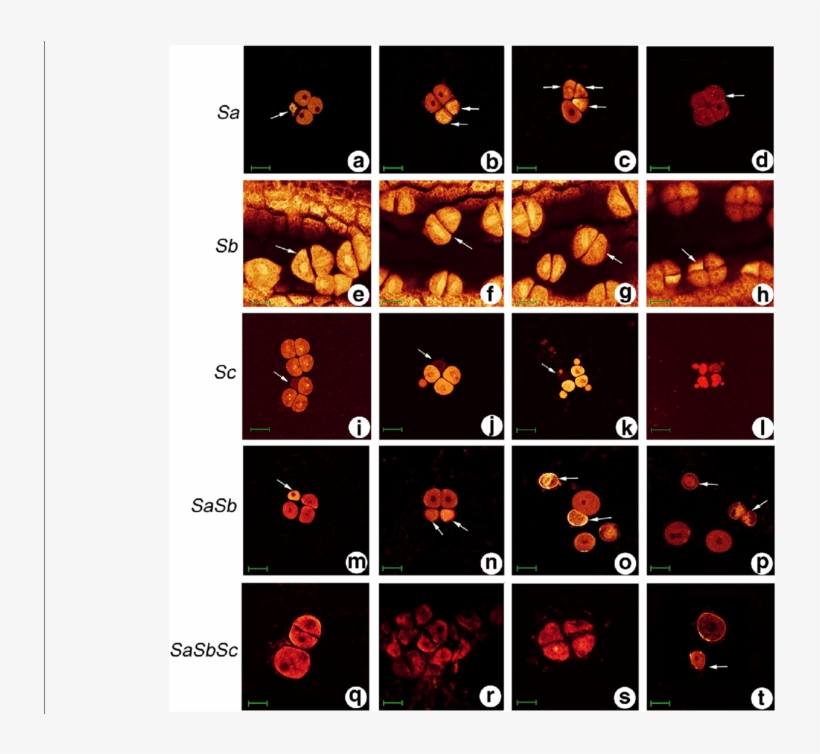 Pollen Abortion Stages Of Autotetraploid Rice Hybrids - Abortion, transparent png download