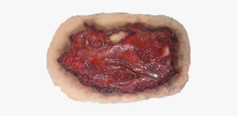 Realistic Scar Png - Wound Png, transparent png download