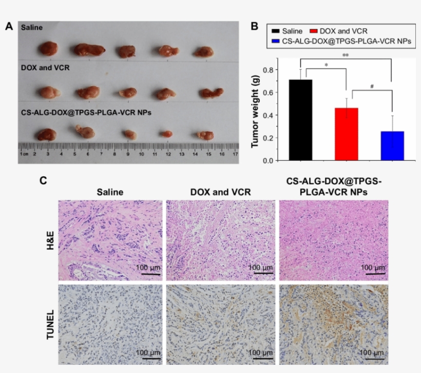 The Comparison Of In Vivo Antitumor Efficiency Between - Dox He Tunel Tumor, transparent png download
