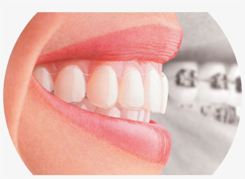 Improve Your Speech - Theory And Advanced Researches In Orthodontics, transparent png download