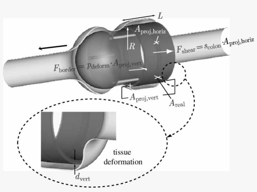 Colonic Tissue Wrapping In The Case Of Geometry - Diagram, transparent png download