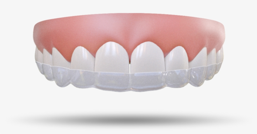 Hard Night Guard - Mouthguard, transparent png download