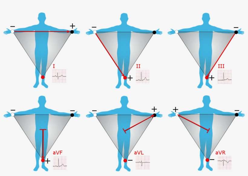 Limb Leads Of Ekg - Limb Leads Of Ecg, transparent png download