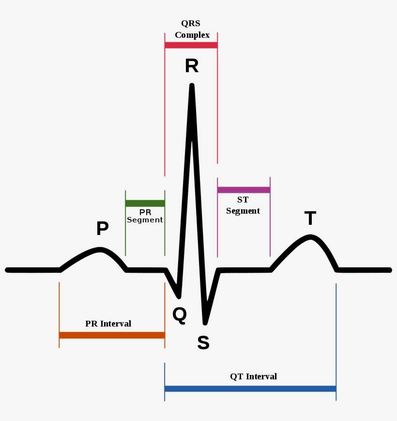 I'm Pretty Sure It's An Ekg, Because Of Her Sound/heartbeat- - Qt Interval, transparent png download