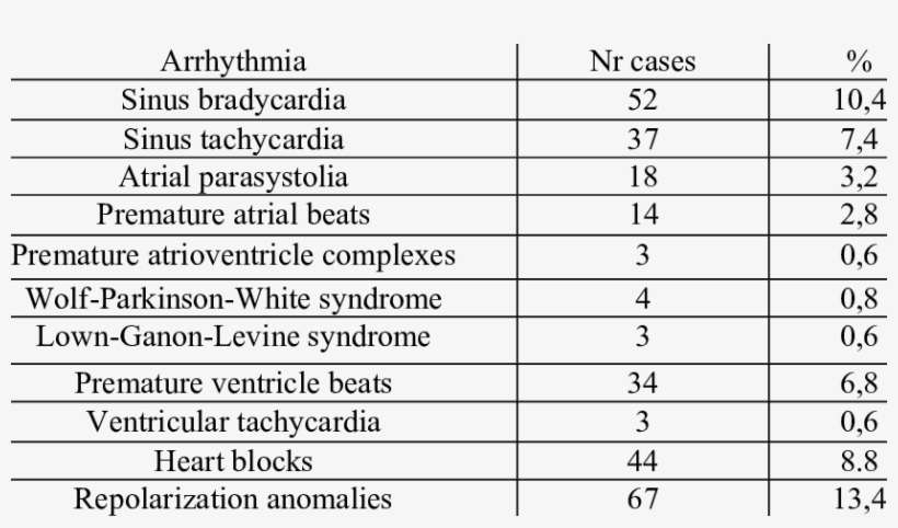 Ekg Anomalies Download Table - Ekg Abnormalities, transparent png download