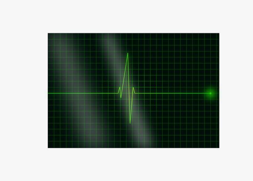 Heartbeat, Pulse, Heart, Signal, Ekg, Electrocardiogram - Green Heart Signal Png, transparent png download