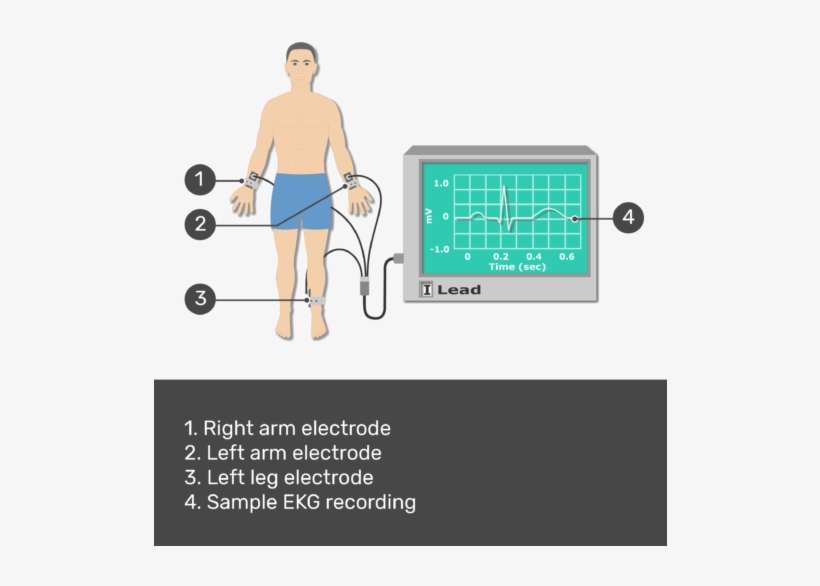 Test Yourself Image For The Placement Of Ecg Electrodes - Ecg Placement Arm, transparent png download