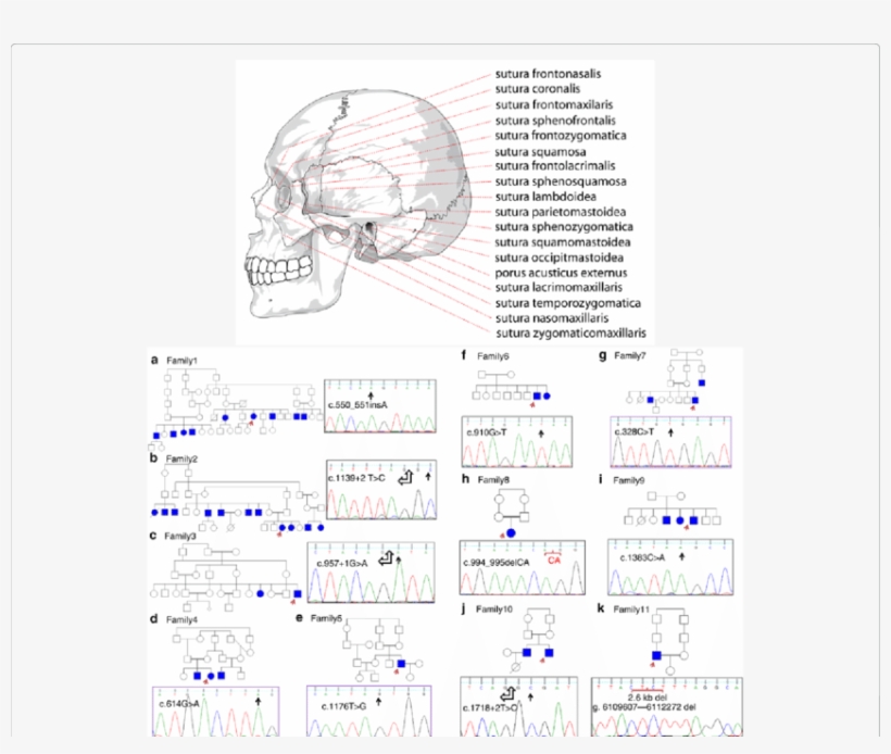 Schematic View Of Human Skull Sutures And Nucleotide - Human Skull Side View, transparent png download