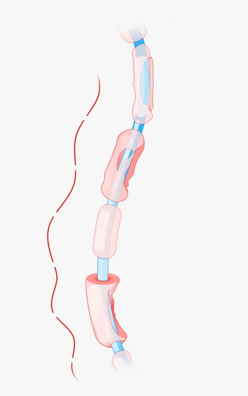Rosenberg, "neurological Diseases In Relation To The - Illustration, transparent png download