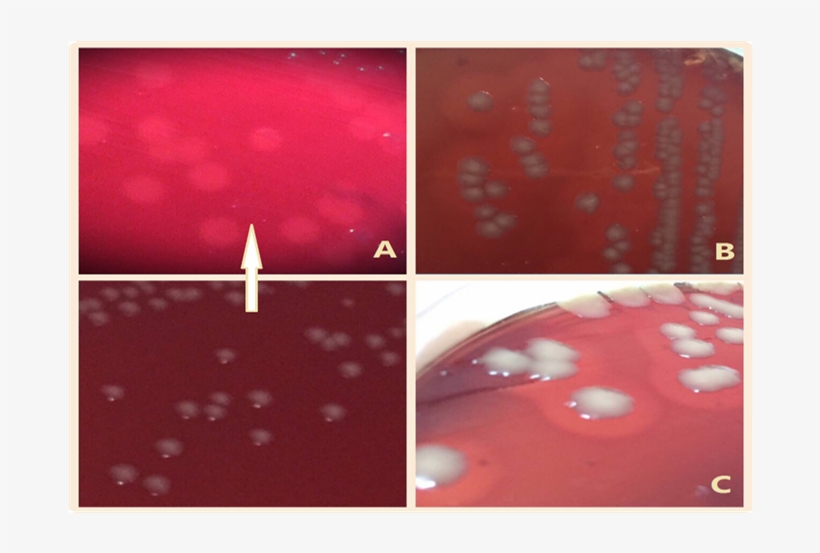 Haemolytica Colonies On B - Pasteurella, transparent png download