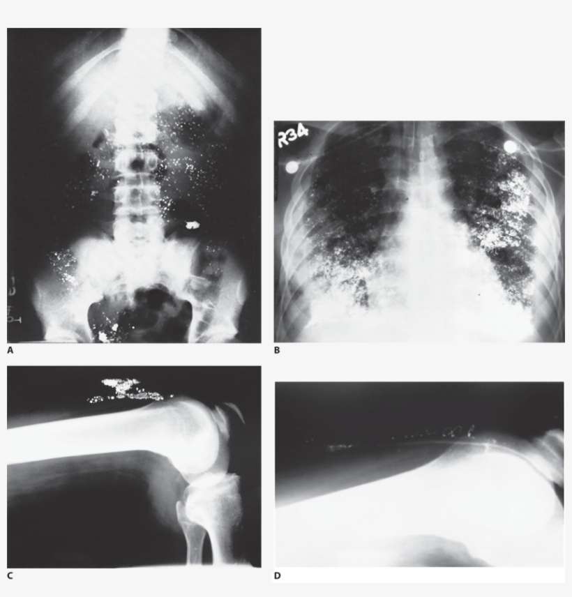 Image Not Available - Radiology, transparent png download